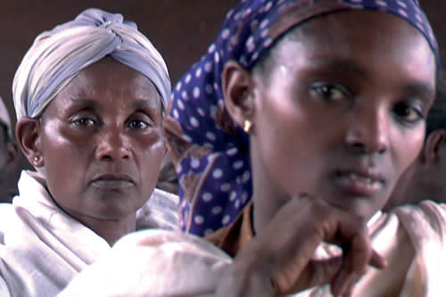 FGM